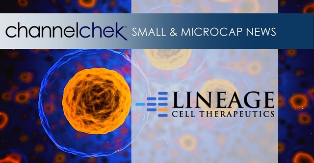 Release – Lineage Establishes New R and D Facility in U.S. and Expands Current GMP Manufacturing Facility in Israel